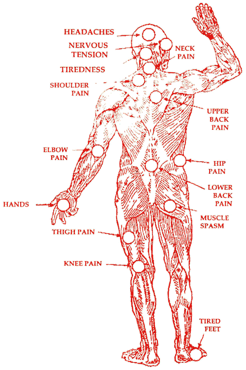 Helpful diagram of bits of people that can feel pain