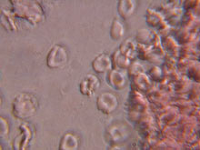 Blood cells!